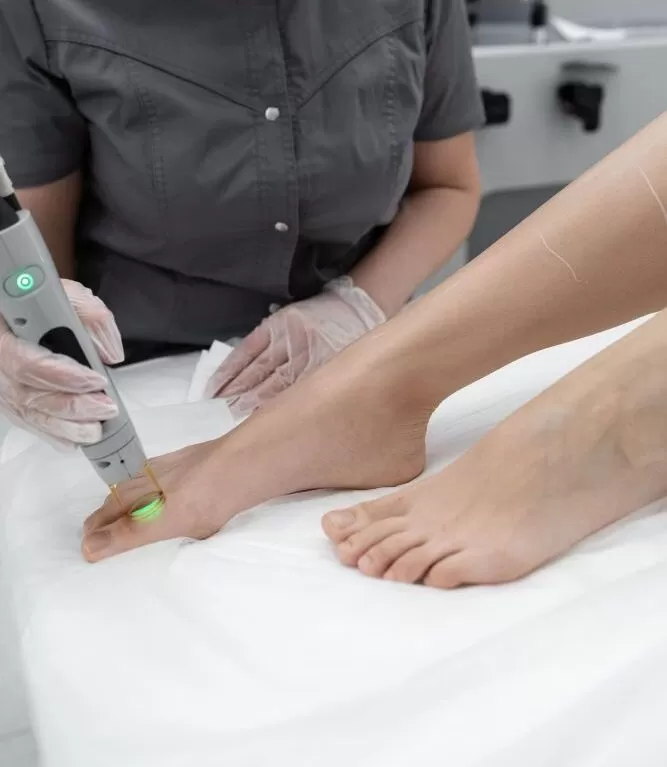 Эпиляция пальцев ног